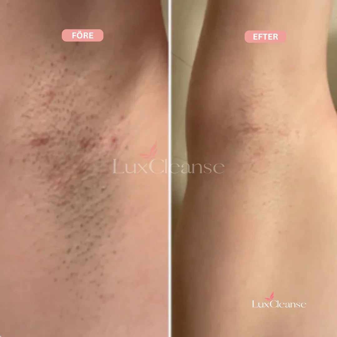 Bikini Trimmer™ – For en feilfri, glatt hud uten irritasjon