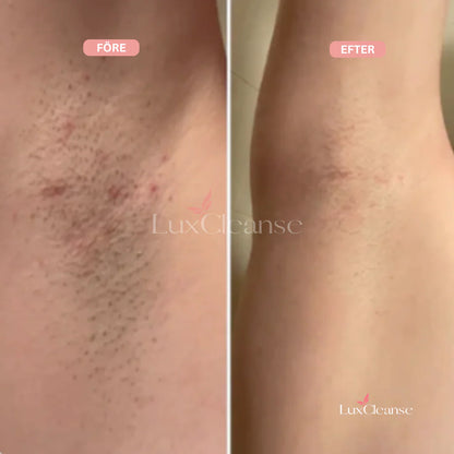 Bikini Trimmer™- För en felfri, len hud utan irritation