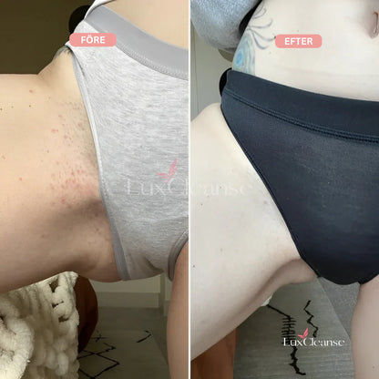 Bikini Trimmer™- För en felfri, len hud utan irritation