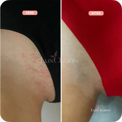 Bikini Trimmer™- För en felfri, len hud utan irritation