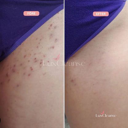 Bikini Trimmer™ – For en feilfri, glatt hud uten irritasjon